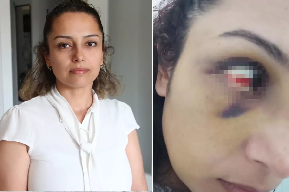 Burcu öğretmenin yardım çığlığı: Kurtarın beni