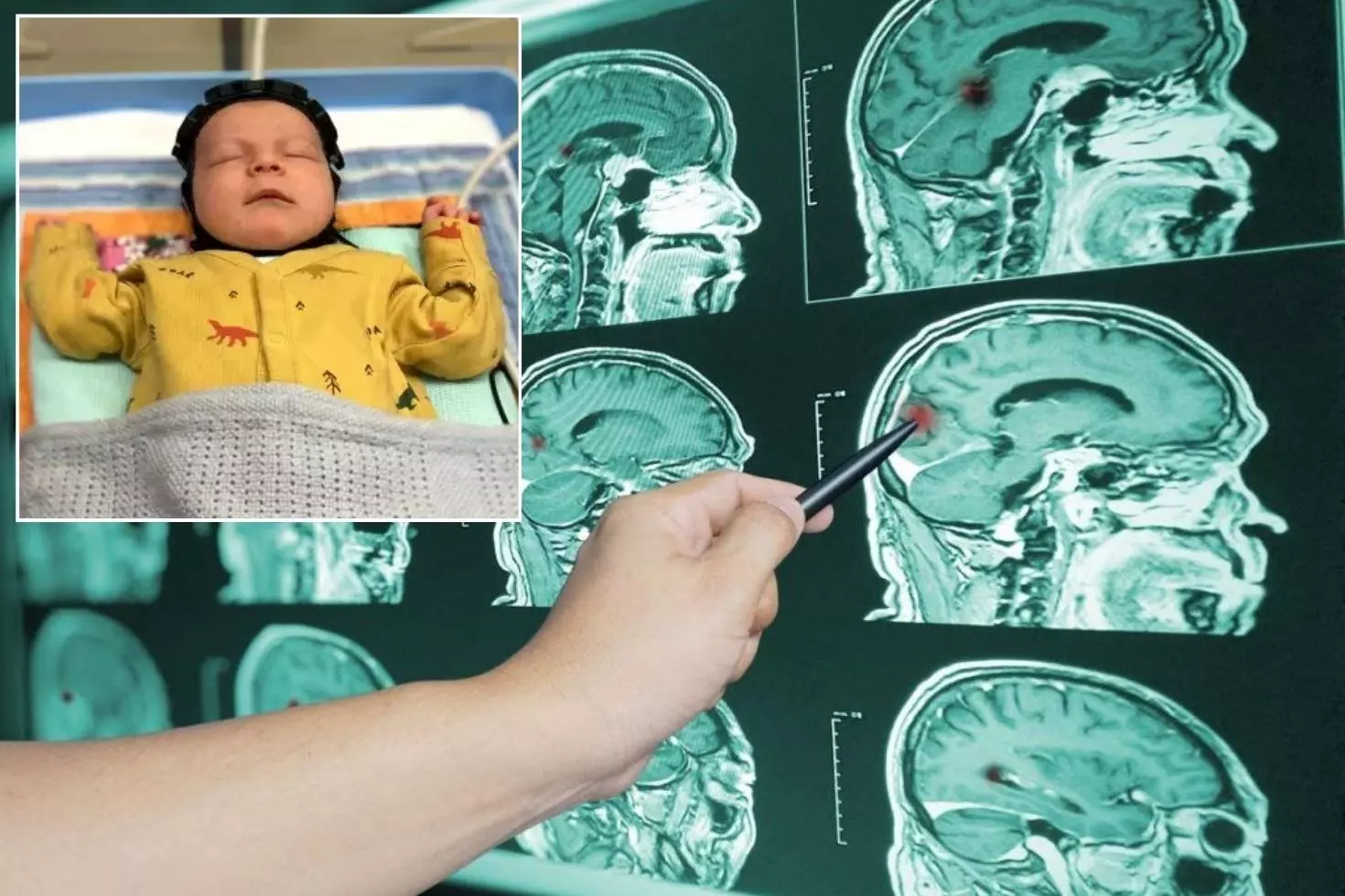 Kayseri'de Yayalara Çarpan Araç 5 Kişiyi Yaraladı